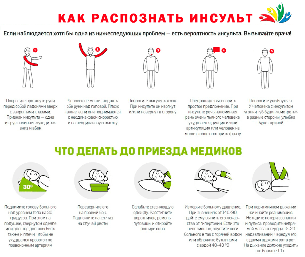 как распознать инсульт