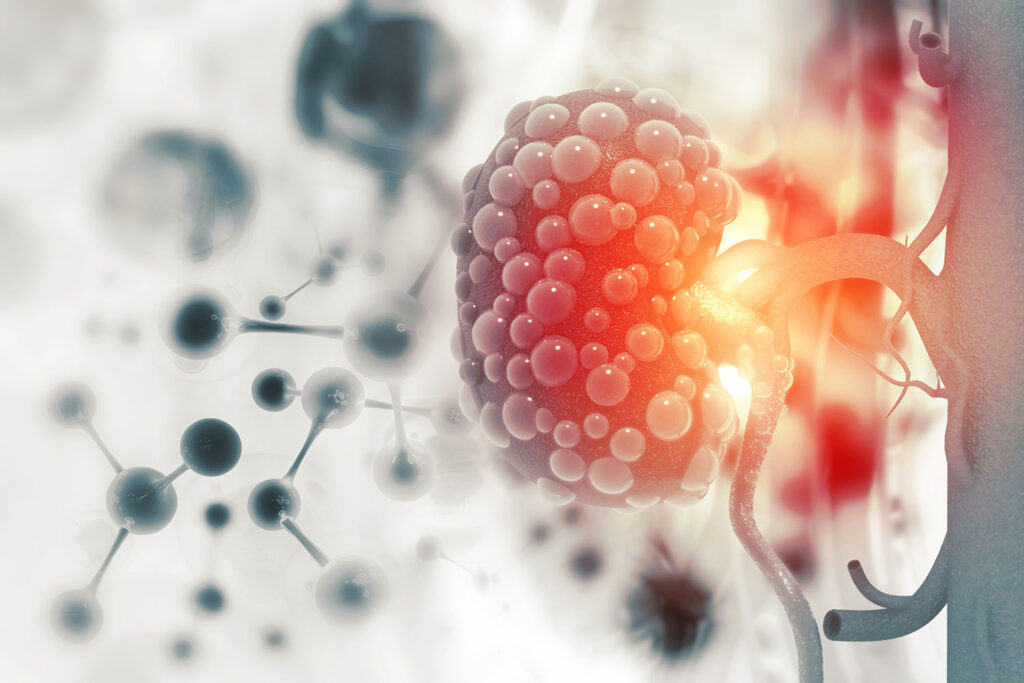 уролог в Днепре